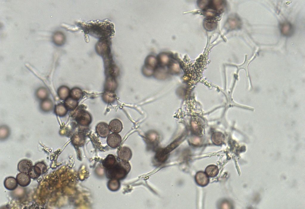 Physarum cf pusillum